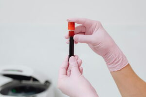 exame de sangue