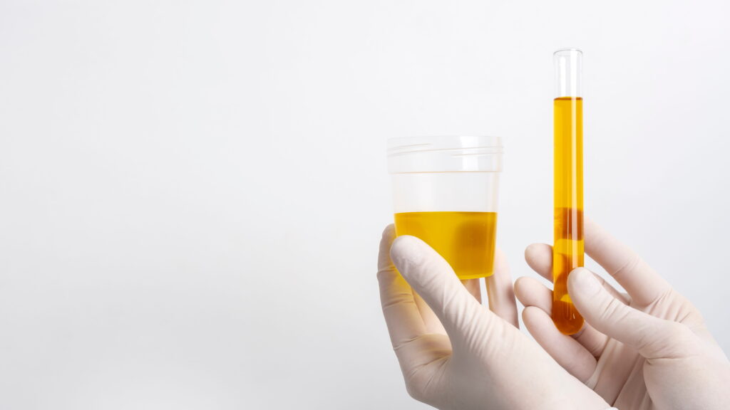 infecção urinária