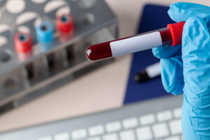 Tubos de coleta de sangue em laboratório.