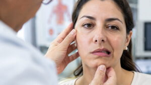 paralisia facial